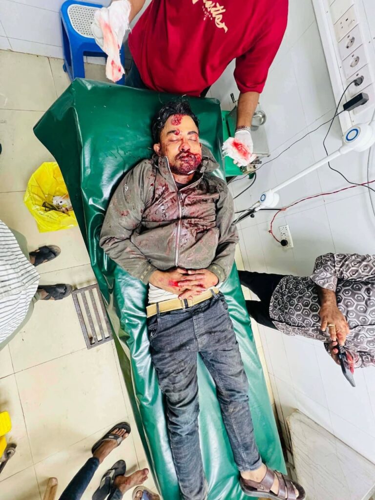 চকরিয়ার বদরখালীতে মোটরসাইকেল দূর্ঘটনায় আহত-২